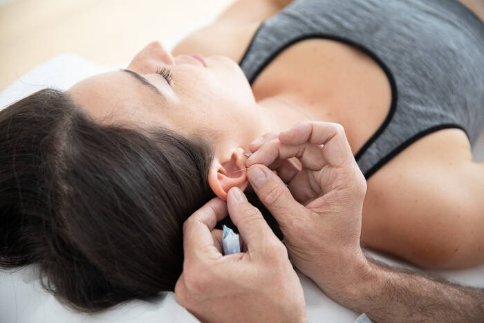 Ear Acupuncture