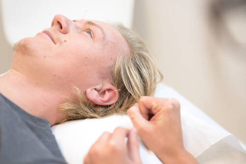 Acupunctures for Allergies and Intolerances